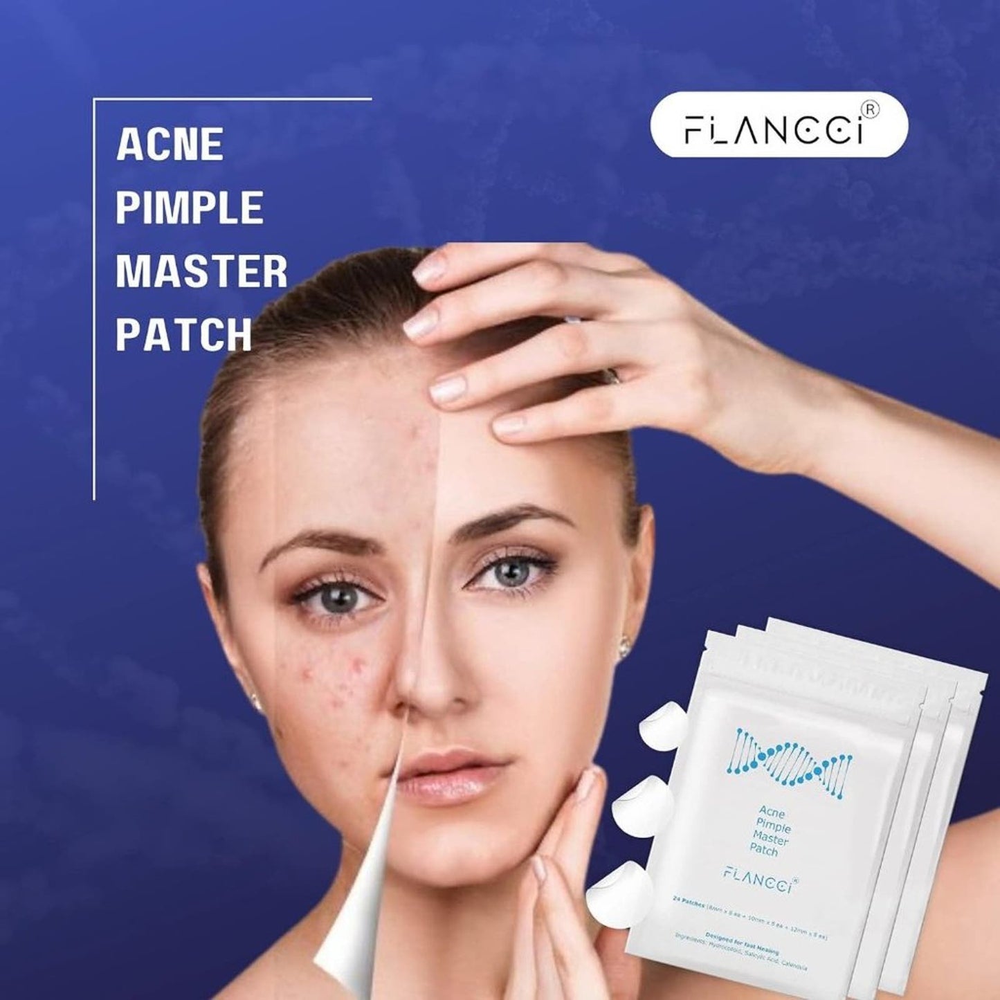 Pimple Patch Acne Patches Facial Skin Care Products, Blackhead Remover Skincare