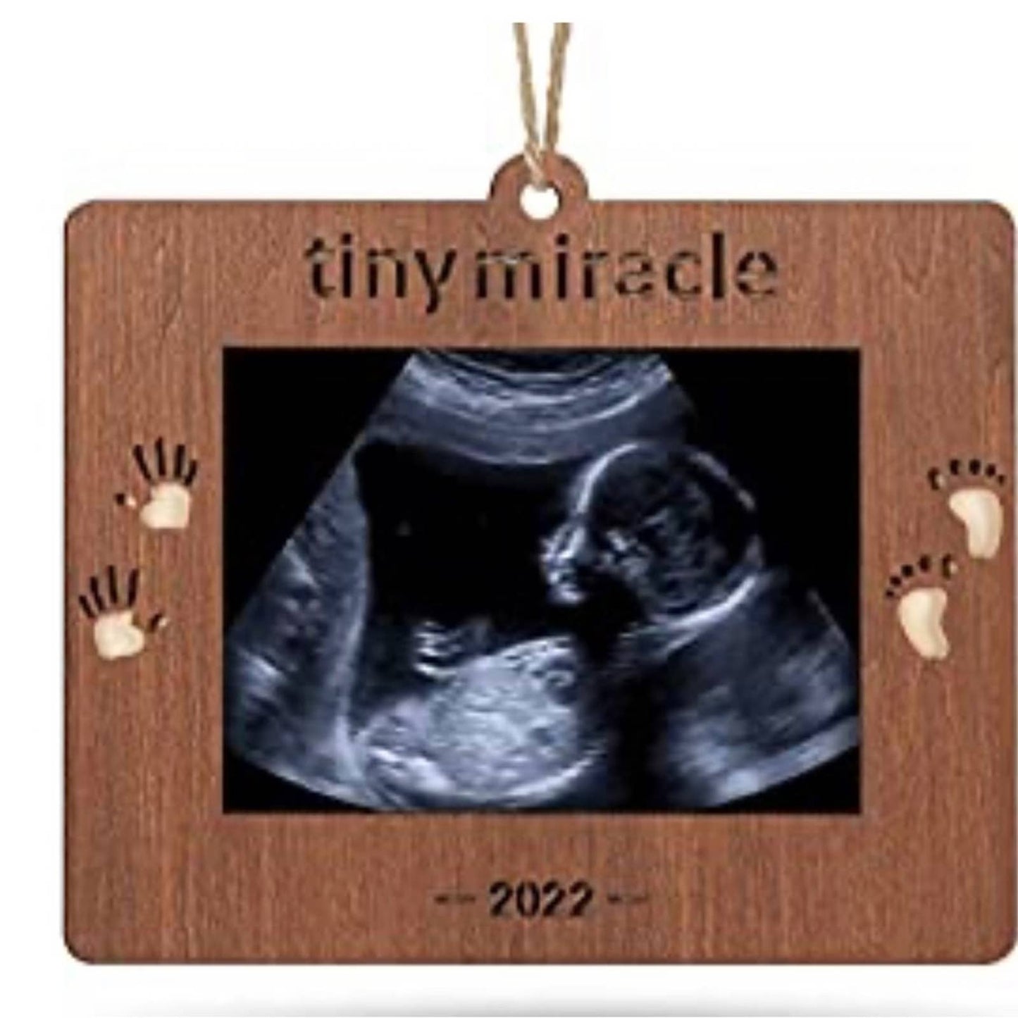 Creawoo 2022 Tiny Miracle Christmas Ornament Sonogram Picture Frame Baby